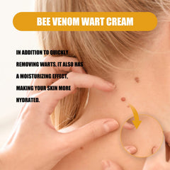 Ximonth Bee Venom Wart Cream