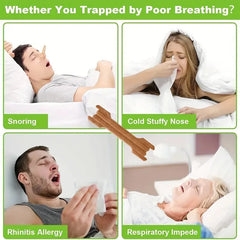 Breath Nasal Strips – Stop Snoring Aid