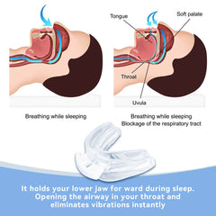 Adjustable Anti-Snoring Mouthpiece – Sleep Aid & Bruxism Guard