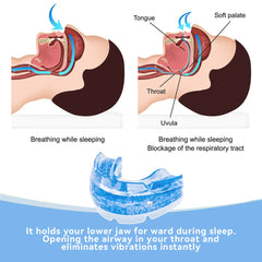 Anti-Snore Mouth Guard – Bruxism & Sleep Apnea Relief Device
