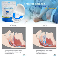 Anti-Snore Mouth Guard – Silicone Bruxism & Sleep Apnea Aid