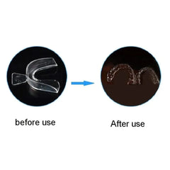 Anti-Snoring Mouth Guard – 2/4PCS Night Guard for Teeth Grinding